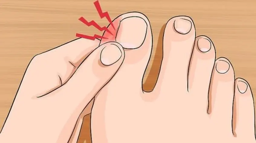 Ilustración de un pie con dolor en los dedos